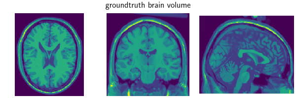 groundtruth brain volume