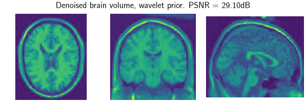 Denoised brain volume, wavelet prior. PSNR = 29.10dB