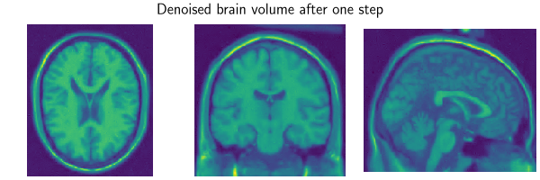 Denoised brain volume after one step