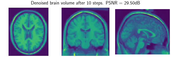 Denoised brain volume after 10 steps. PSNR = 29.50dB