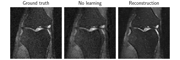 Ground truth, No learning, Reconstruction
