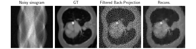 Noisy sinogram, GT, Filtered Back-Projection, Recons.