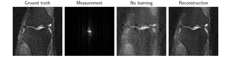 Ground truth, Measurement, No learning, Reconstruction