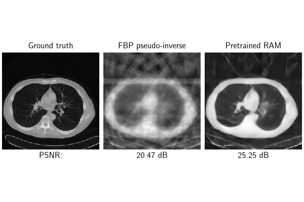 Ground truth, FBP pseudo-inverse, Pretrained RAM