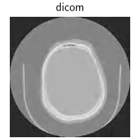 dicom