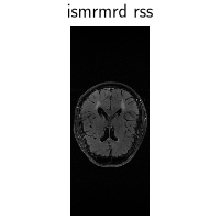 ismrmrd rss