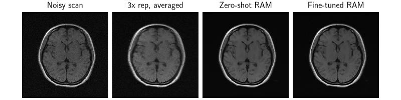 Noisy scan, 3x rep, averaged, Zero-shot RAM, Fine-tuned RAM