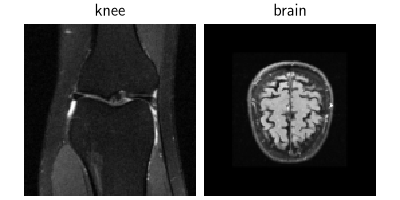knee, brain