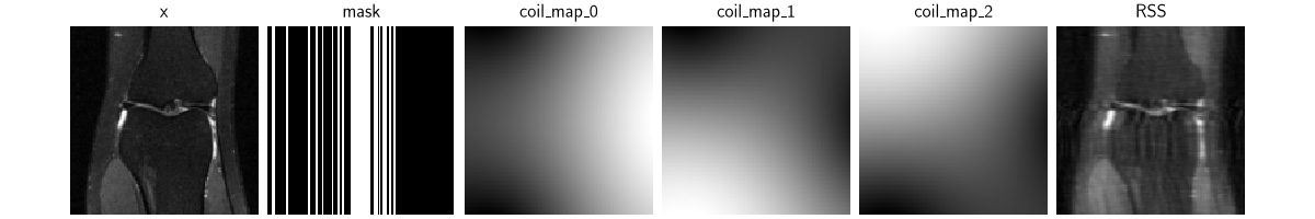 x, mask, coil_map_0, coil_map_1, coil_map_2, RSS