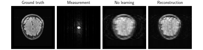Ground truth, Measurement, No learning, Reconstruction