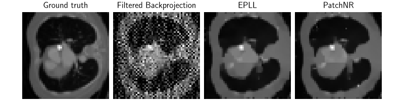 Ground truth, Filtered Backprojection, EPLL, PatchNR