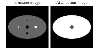 Emission image, Attenuation image