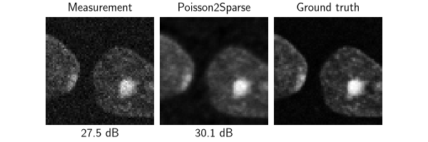 Measurement, Poisson2Sparse, Ground truth
