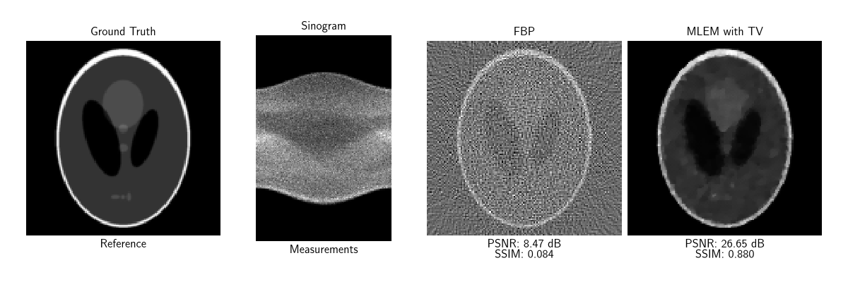 Ground Truth, Sinogram, FBP, MLEM with TV