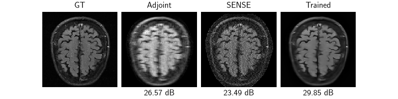GT, Adjoint, SENSE, Trained