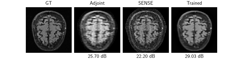 GT, Adjoint, SENSE, Trained