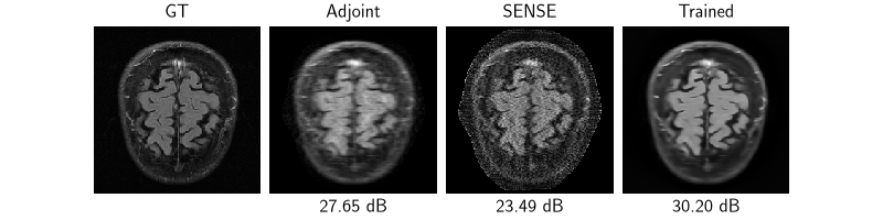 GT, Adjoint, SENSE, Trained