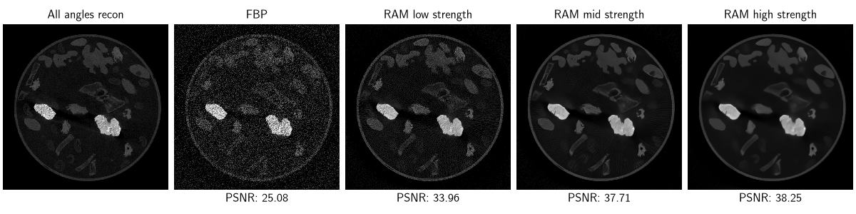 All angles recon, FBP, RAM low strength, RAM mid strength, RAM high strength