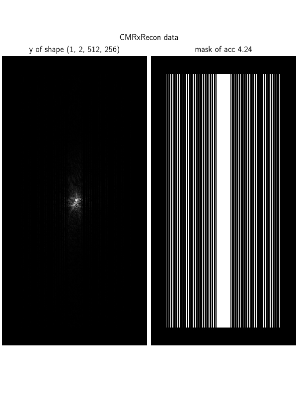 CMRxRecon data, y of shape (1, 2, 512, 256), mask of acc 4.24