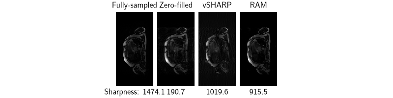 Fully-sampled, Zero-filled, vSHARP, RAM