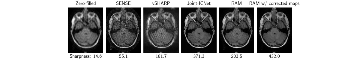 Zero-filled, SENSE, vSHARP, Joint-ICNet, RAM, RAM w/ corrected maps