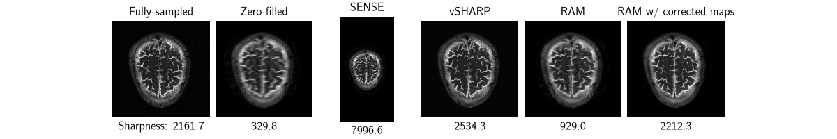 Fully-sampled, Zero-filled, SENSE, vSHARP, RAM, RAM w/ corrected maps