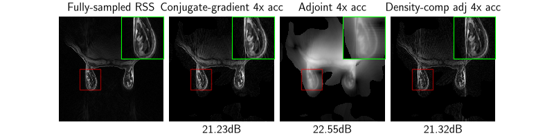 Fully-sampled RSS, Conjugate-gradient 4x acc, Adjoint 4x acc, Density-comp adj 4x acc