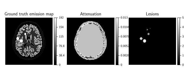 Ground truth emission map, Attenuation, Lesions
