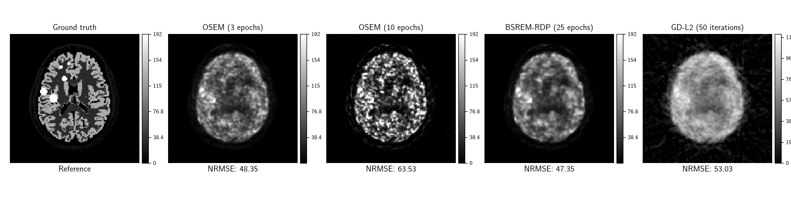 Ground truth, OSEM (3 epochs), OSEM (10 epochs), BSREM-RDP (25 epochs), GD-L2 (50 iterations)