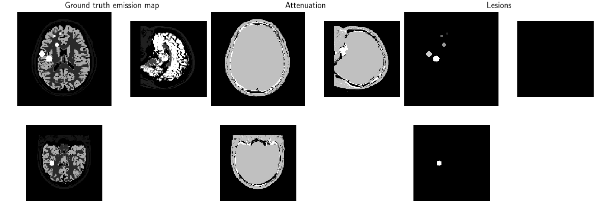 Ground truth emission map, Attenuation, Lesions