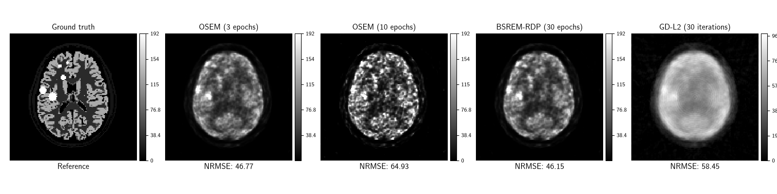 Ground truth, OSEM (3 epochs), OSEM (10 epochs), BSREM-RDP (30 epochs), GD-L2 (30 iterations)