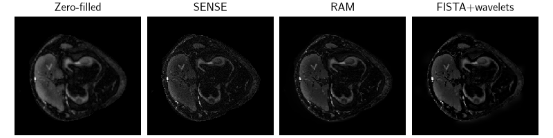 Zero-filled, SENSE, RAM, FISTA+wavelets