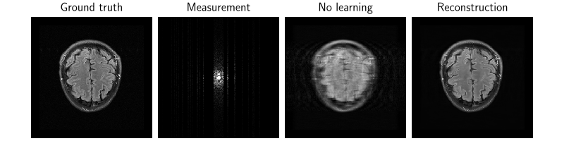 Ground truth, Measurement, No learning, Reconstruction