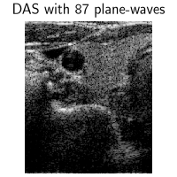 DAS with 87 plane-waves