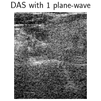 DAS with 1 plane-wave